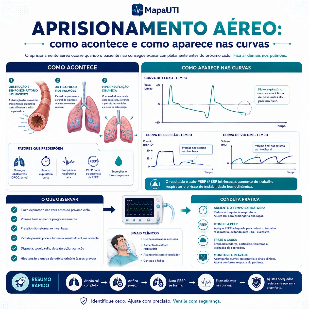 Aprisionamento Aéreo